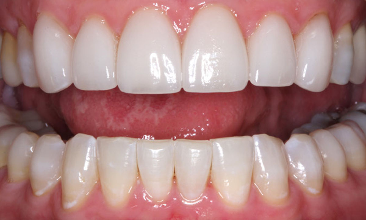 Dentalays Design Before & After