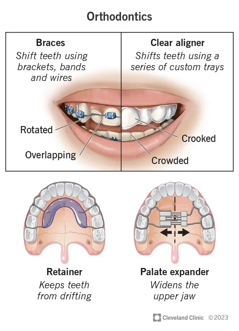 orthodontics in turkey