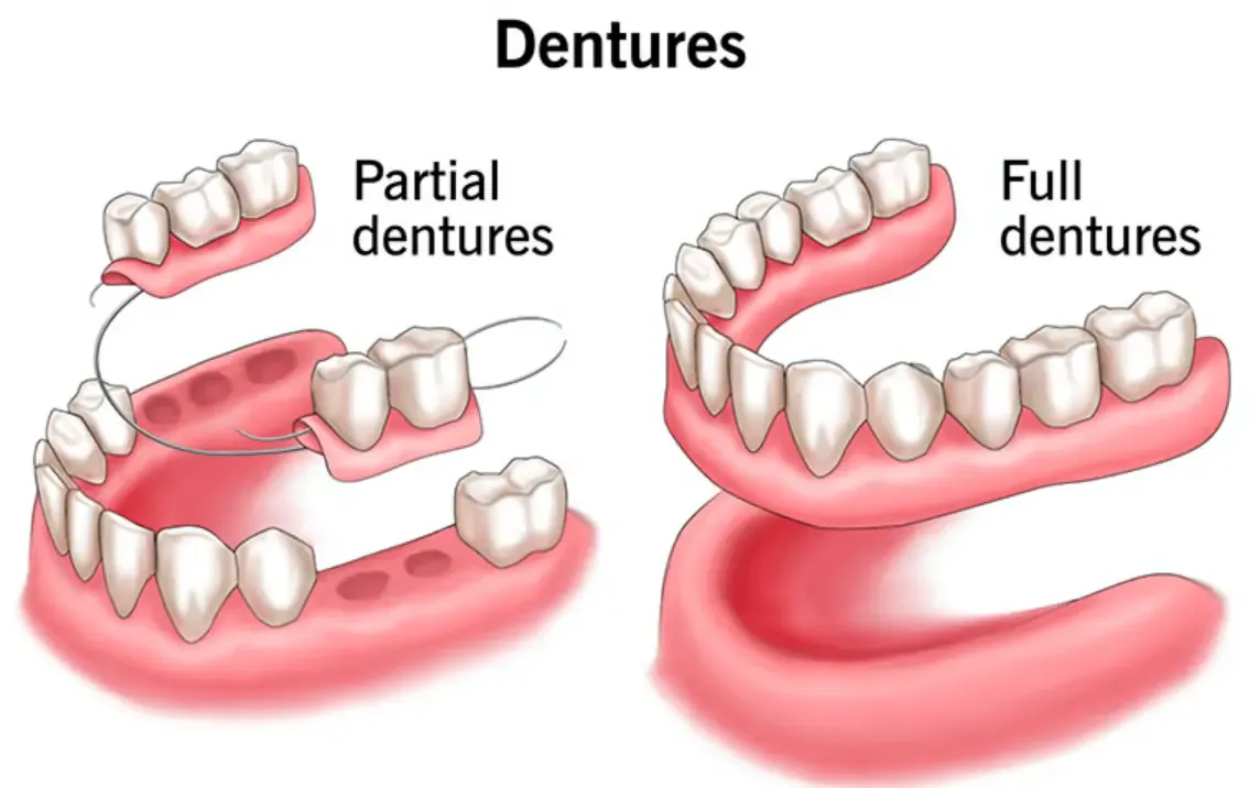 dentures turkey