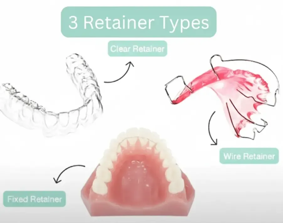 teeth retainer.webp